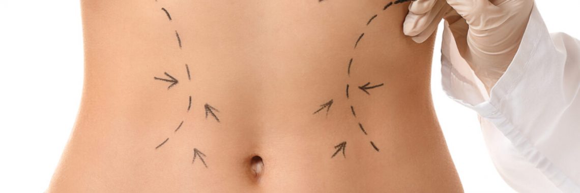 Lipoaspiração